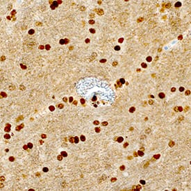 TDP-43/TARDBP antibody in Human Brain by Immunohistochemistry (IHC-P).