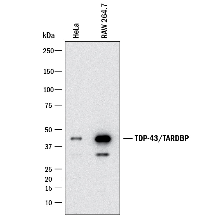 Detection of Human and Mouse TDP-43/TARDBP antibody by Western Blot.