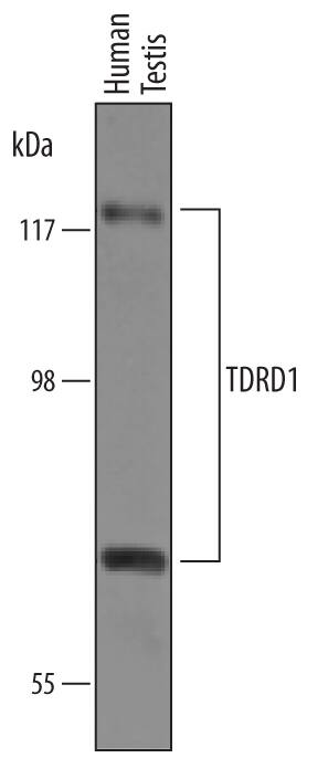 Detection of Human TDRD1 antibody by Western Blot.