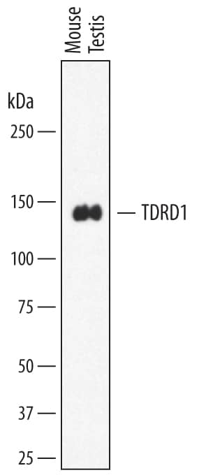 Detection of Mouse TDRD1 antibody by Western Blot.