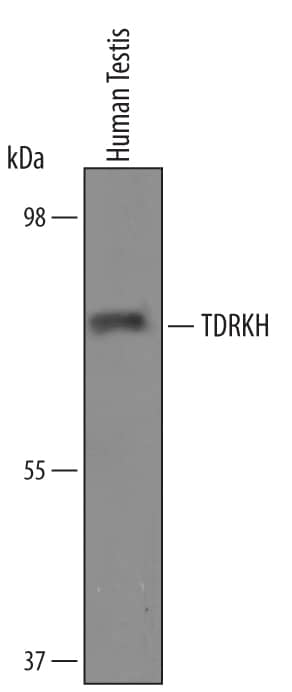 Detection of Human TDRKH antibody by Western Blot.