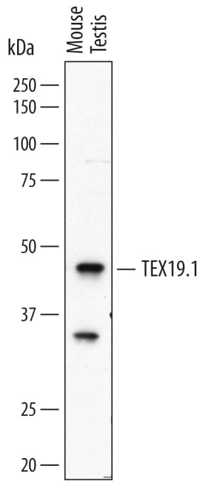 Detection of Mouse TEX19.1 antibody by Western Blot.