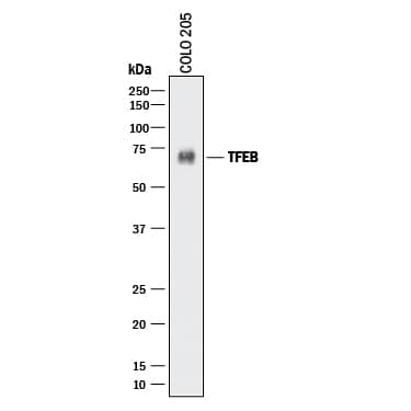 Detection of Human TFEB antibody by Western Blot.