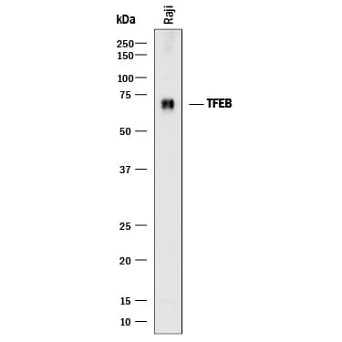 Detection of Human TFEB antibody by Western Blot.