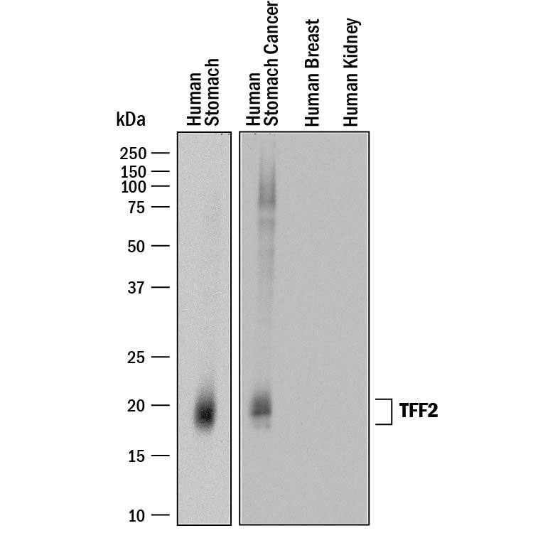 Detection of Human TFF2 antibody by Western Blot.