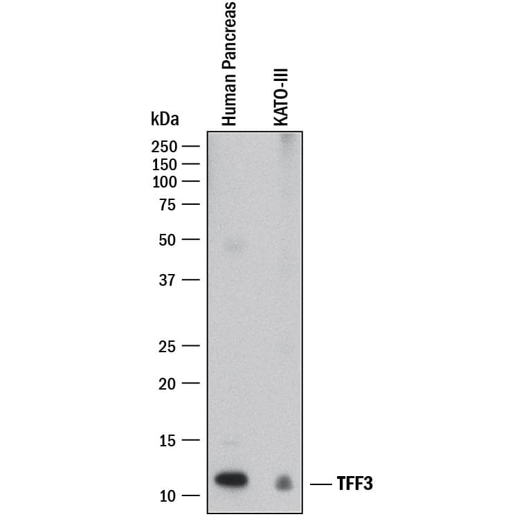 Detection of Human TFF3 antibody by Western Blot.