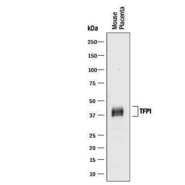 Detection of TFPI antibody by Western Blot.