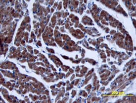 TGF-beta 3 antibody in Human Heart by Immunohistochemistry (IHC-P).