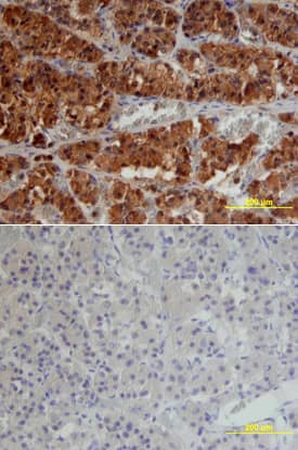 TGF-beta  RII antibody in Human Pituitary by Immunohistochemistry (IHC-P).