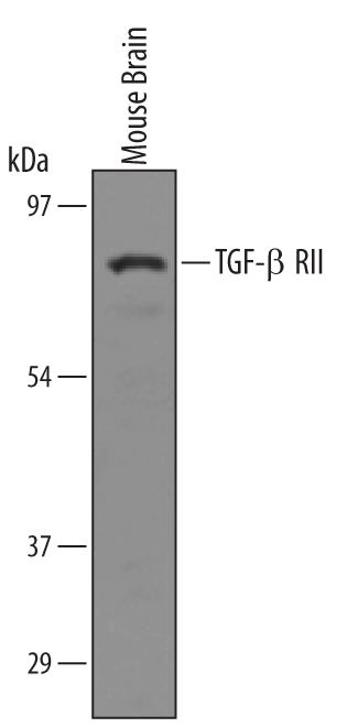 Detection of Mouse TGF-beta  RII antibody by Western Blot.