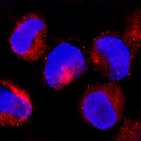 LAP (TGF-beta 1) antibody in K562 Human Cell Line by Immunocytochemistry (ICC).