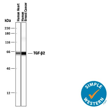 Detection of Human TGF-beta 2 antibody by Simple WesternTM.