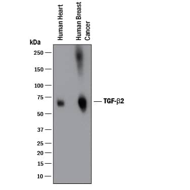 Detection of Human TGF-beta 2 antibody by Western Blot.