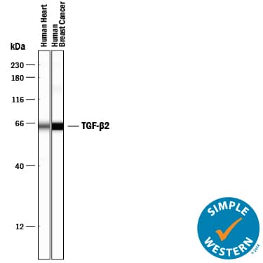 Detection of Human TGF-beta 2 antibody by Simple WesternTM.