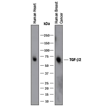 Detection of Human TGF-beta 2 antibody by Western Blot.