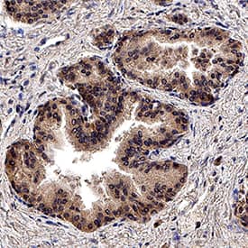 TGF-beta Pan Specific antibody in Human Prostate Tissue by Immunohistochemistry (IHC-P).