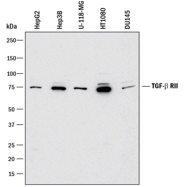 Detection of Human TGF-beta  RII antibody by Western Blot.