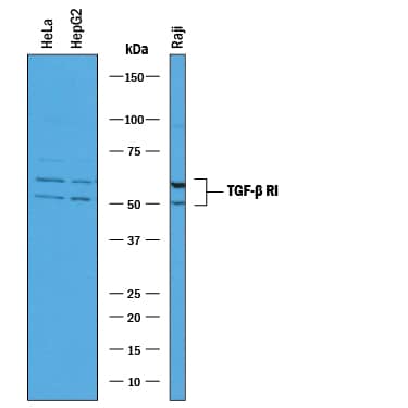 Detection of Human TGF-beta  RI/ALK-5 antibody by Western Blot.