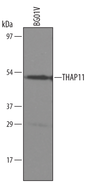 Detection of Human THAP11 antibody by Western Blot.