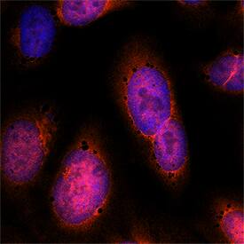 TIGAR/C12orf5 antibody in U2OS Human Cell Line by Immunocytochemistry (ICC).