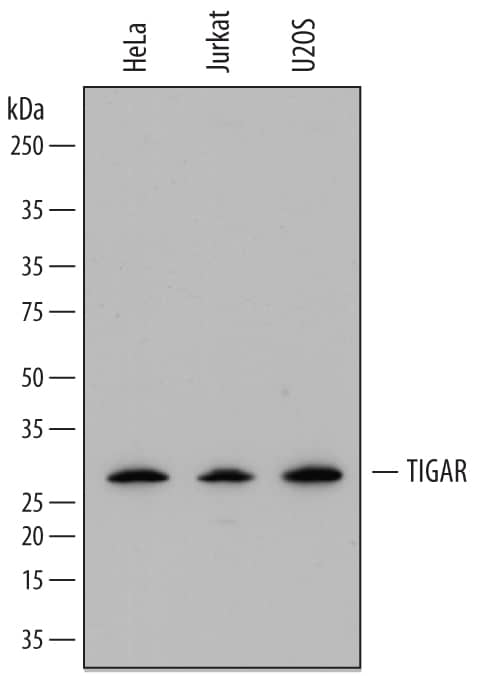 Detection of Human TIGAR/C12orf5 antibody by Western Blot.