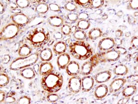 TIM-1/KIM-1/HAVCR antibody in Human Kidney by Immunohistochemistry (IHC-P).