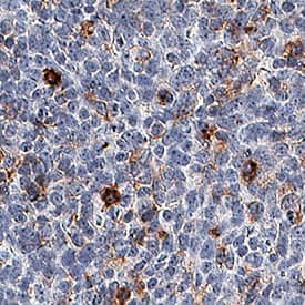 TIM-3 antibody in Human Tonsil by Immunohistochemistry (IHC-P).