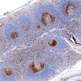 TIM-3 antibody in Human Tonsil by Immunohistochemistry (IHC-P).