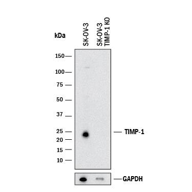Western Blot Shows Human TIMP-1 Antibody Specificity by Using Knockout Cell Line.
