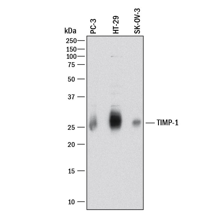 Detection of Human TIMP-1 antibody by Western Blot.