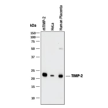 Detection of Human TIMP-2 antibody by Western Blot.