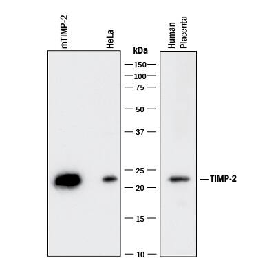 Detection of Human TIMP-2 antibody by Western Blot.