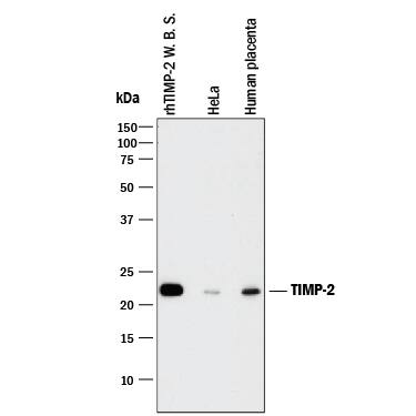 Detection of Human TIMP-2 antibody by Western Blot.