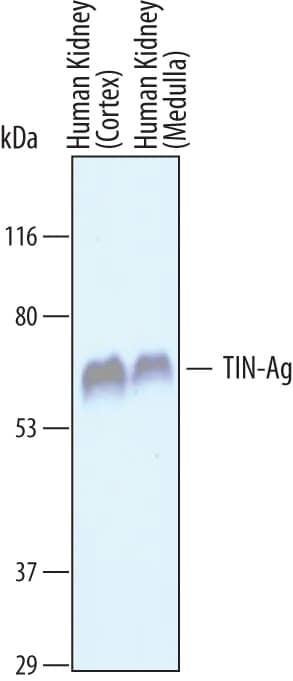 Detection of Human TIN-Ag antibody by Western Blot.