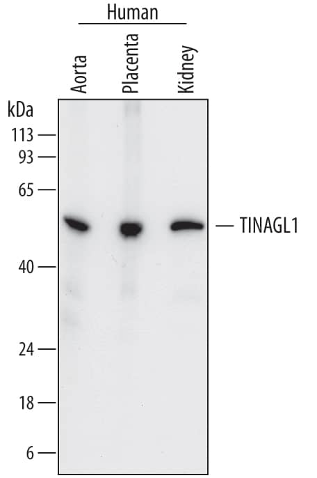 Detection of Human TINAGL1 antibody by Western Blot.