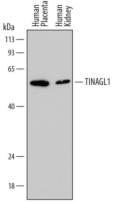 Detection of Human TINAGL1 antibody by Western Blot.