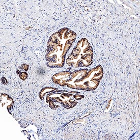 TL1A/TNFSF15 antibody in Human Prostate by Immunohistochemistry (IHC-P).