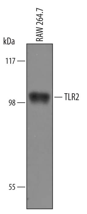 Detection of Mouse TLR2 antibody by Western Blot.