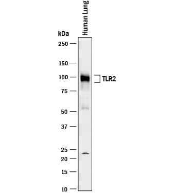 Detection of Human TLR2 antibody by Western Blot.