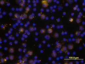 TLR4 antibody in Human PBMCs by Immunocytochemistry (ICC).