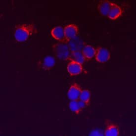 TLR9 antibody in Mouse Splenocytes by Immunocytochemistry (ICC).