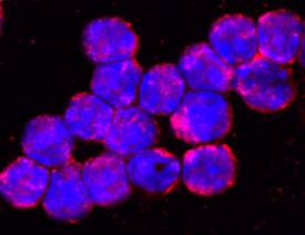 TLR9 antibody in Mouse Splenocytes by Immunocytochemistry (ICC).