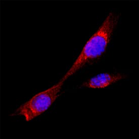TMED1 antibody in A549 Human Cell Line by Immunocytochemistry (ICC).