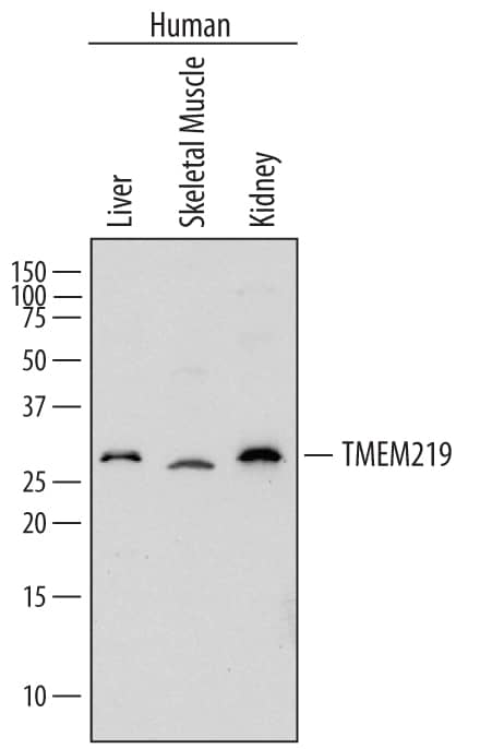 Detection of Human TMEM219 antibody by Western Blot.