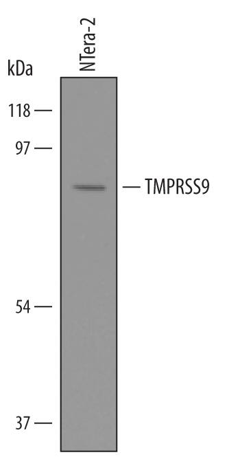 Detection of Human TMPRSS9 antibody by Western Blot.