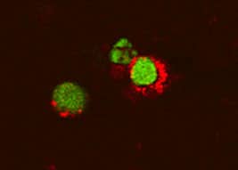 TNF‑ alpha in Mouse T Cells. TNF-a antibody in Mouse T Cells by Immunocytochemistry (ICC).