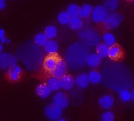 Lymphotoxin-a/TNF-beta  antibody in Human PBMCs by Immunocytochemistry (ICC).