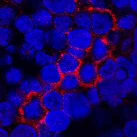 TNF RII/TNFRSF1B antibody in Human PBMCs by Immunocytochemistry (ICC).