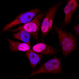 TOP2A antibody in HeLa Human Cell Line by Immunocytochemistry (ICC).