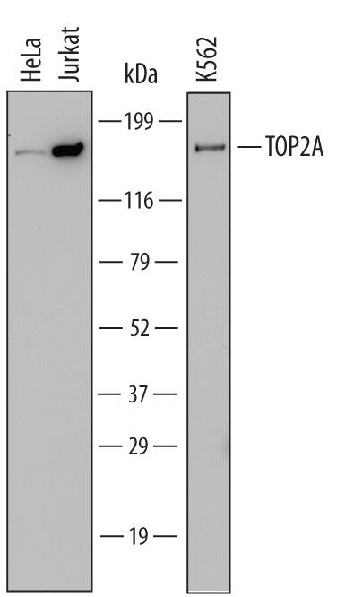 Detection of Human TOP2A antibody by Western Blot.